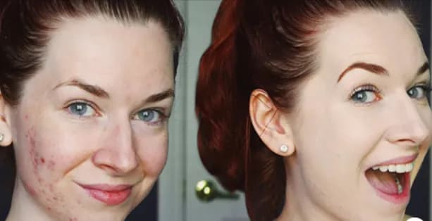 Miya serum rewitalizujące opinie: co mówią użytkownicy o efektach?